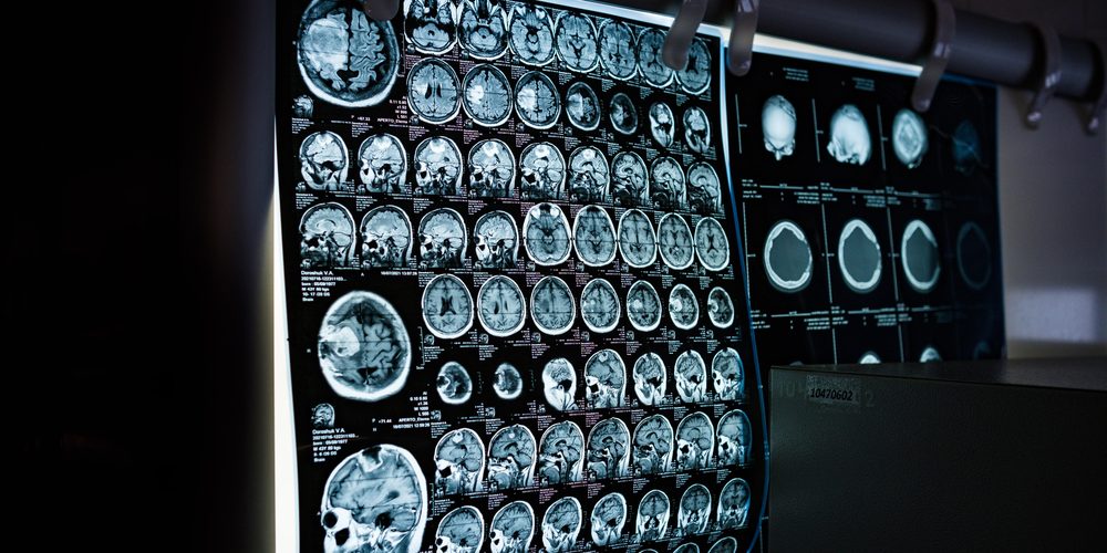 Radiology imaging on a diagnostic light box